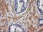 DES Antibody in Immunohistochemistry (Paraffin) (IHC (P))