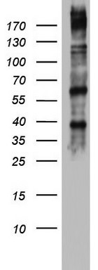 DICER1 Antibody in Western Blot (WB)