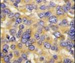 DKK3 Antibody in Immunohistochemistry (IHC)