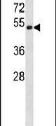 DKK3 Antibody in Western Blot (WB)