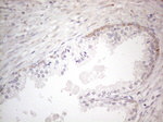 DLX4 Antibody in Immunohistochemistry (Paraffin) (IHC (P))