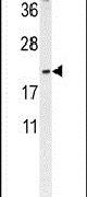 DMRTC1 Antibody in Western Blot (WB)