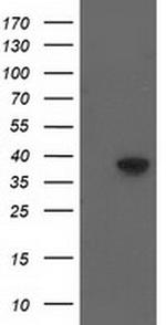 DNAJB1 Antibody in Western Blot (WB)