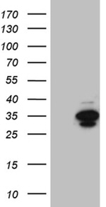 DNAJB6 Antibody in Western Blot (WB)