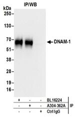 DNAM-1 Antibody in Western Blot (WB)