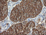 DNM1L Antibody in Immunohistochemistry (Paraffin) (IHC (P))