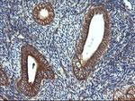 DNM1L Antibody in Immunohistochemistry (Paraffin) (IHC (P))