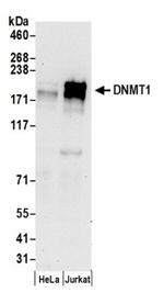 DNMT1 Antibody in Western Blot (WB)