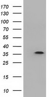 DNTTIP1 Antibody in Western Blot (WB)