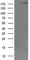 DOCK8 Antibody in Western Blot (WB)