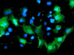 DOK7 Antibody in Immunocytochemistry (ICC/IF)