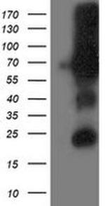 DPP3 Antibody in Western Blot (WB)