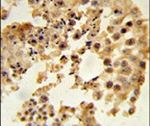 DPP8 Antibody in Immunohistochemistry (IHC)