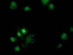 DSTN Antibody in Immunocytochemistry (ICC/IF)