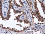 DSTN Antibody in Immunohistochemistry (Paraffin) (IHC (P))