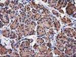 DSTN Antibody in Immunohistochemistry (Paraffin) (IHC (P))