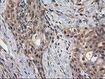 DSTN Antibody in Immunohistochemistry (Paraffin) (IHC (P))