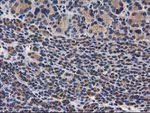 DSTN Antibody in Immunohistochemistry (Paraffin) (IHC (P))