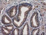 DSTN Antibody in Immunohistochemistry (Paraffin) (IHC (P))