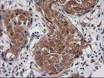 DSTN Antibody in Immunohistochemistry (Paraffin) (IHC (P))