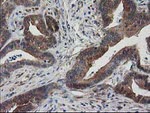 DSTN Antibody in Immunohistochemistry (Paraffin) (IHC (P))