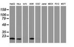 DSTN Antibody in Western Blot (WB)