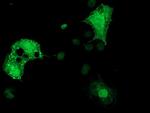 DTNA Antibody in Immunocytochemistry (ICC/IF)