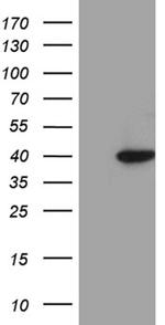 DTWD1 Antibody in Western Blot (WB)