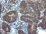 DUPD1 Antibody in Immunohistochemistry (Paraffin) (IHC (P))