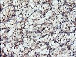 DUPD1 Antibody in Immunohistochemistry (Paraffin) (IHC (P))