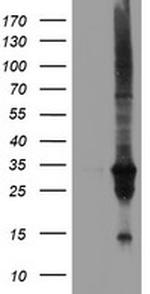 DUPD1 Antibody in Western Blot (WB)