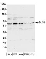 DUS2/DUS2L Antibody in Western Blot (WB)