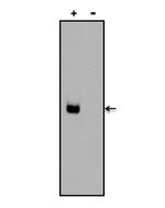 Digoxin Antibody in Western Blot (WB)