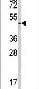 E2F1 Antibody in Western Blot (WB)