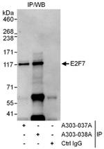E2F7 Antibody in Immunoprecipitation (IP)
