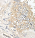 EB1 Antibody in Immunohistochemistry (IHC)