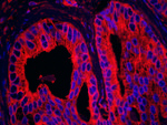 EB1 Antibody in Immunohistochemistry (IHC)