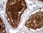 EEF1D Antibody in Immunohistochemistry (Paraffin) (IHC (P))