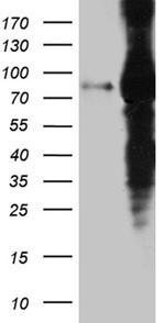 EEF1D Antibody in Western Blot (WB)