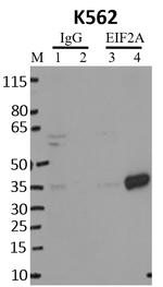 EIF2S1 Antibody in Immunoprecipitation (IP)