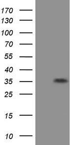 EIF2S1 Antibody in Western Blot (WB)