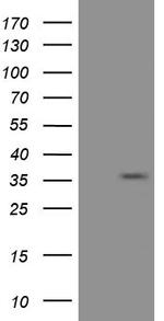 EIF2S1 Antibody in Western Blot (WB)