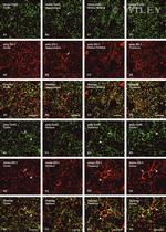 ZO-1 Antibody in Immunohistochemistry (IHC)