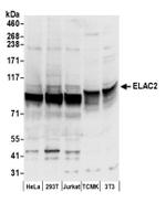 ELAC2 Antibody in Western Blot (WB)