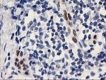 ELK3 Antibody in Immunohistochemistry (Paraffin) (IHC (P))