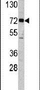 ELP2 Antibody in Western Blot (WB)