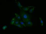 Caveolin-1 Antibody in Immunocytochemistry (ICC/IF)