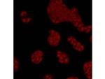 MAPK14 Antibody in Immunocytochemistry (ICC/IF)