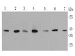 MAPK14 Antibody in Western Blot (WB)