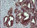 EPCAM Antibody in Immunohistochemistry (Paraffin) (IHC (P))